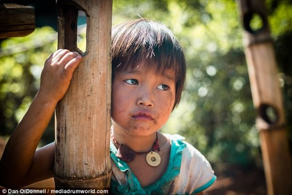 Hủ tục này được duy trì tới năm 1960. Hiện nay cũng không còn nhiều phụ nữ sở hữu “vết sẹo đen” sinh sống tại bộ lạc.