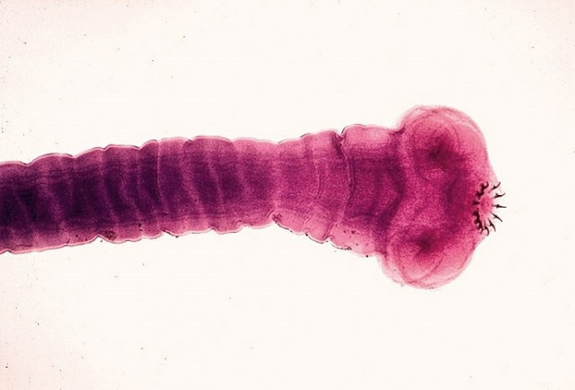 Taenia solium, còn được gọi là sán dải heo hay sán dải lợn. Đây là loài ký sinh trong cơ thể heo và con người. Khi theo máu đi vào não, sán dải heo phát triển, có thể khiến bệnh nhân tử vong nhanh chóng.