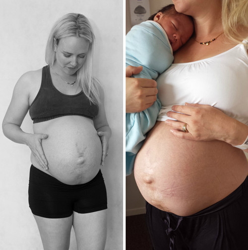 Trong khi nhiều bà mẹ tự ti với thân hình sồ sề thì Julie sẵn sàng lưu lại những bức ảnh ghi lại chi tiết sự thay đổi trên cơ thể mình từ khi sinh đến 14 tuần sau đó.