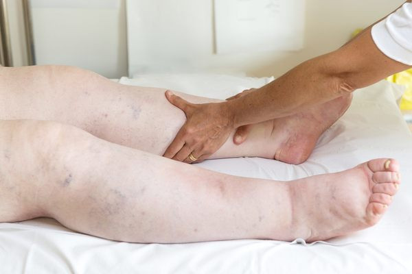 11. Các triệu chứng khác Các triệu chứng được đề cập ở trên là dấu hiệu ung thư phổ biến nhất nhưng vẫn có những điều khác cần chú ý, bao gồm những thứ như bàn chân sưng hay những thay đổi chung về cách cơ thể đang cảm thấy hoặc thể hiện bên ngoài.