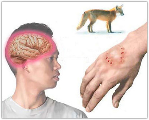 Đặc biệt, những người nghi bị chó dại cắn thường bị tuyệt đối cách ly đám tang, nghĩa trang bởi e ngại vướng phải hơi lạnh khiến chưa kịp chạy chữa đã phát bệnh.