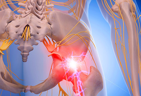 Nguyên nhân gây đau thần kinh tọa do thoái hóa xương: Những động tác này giúp tạo khoảng trống giữa các đốt sống để chúng ít có khả năng chèn ép dây thần kinh tọa gây đau. Ảnh: Internet