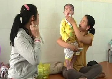 Bệnh sởi giảm, chân tay miệng bùng phát