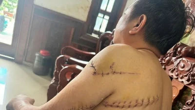 Đồng Nai: Điều tra mở rộng vụ truy sát dã man ông Nguyễn Khắc Tuấn