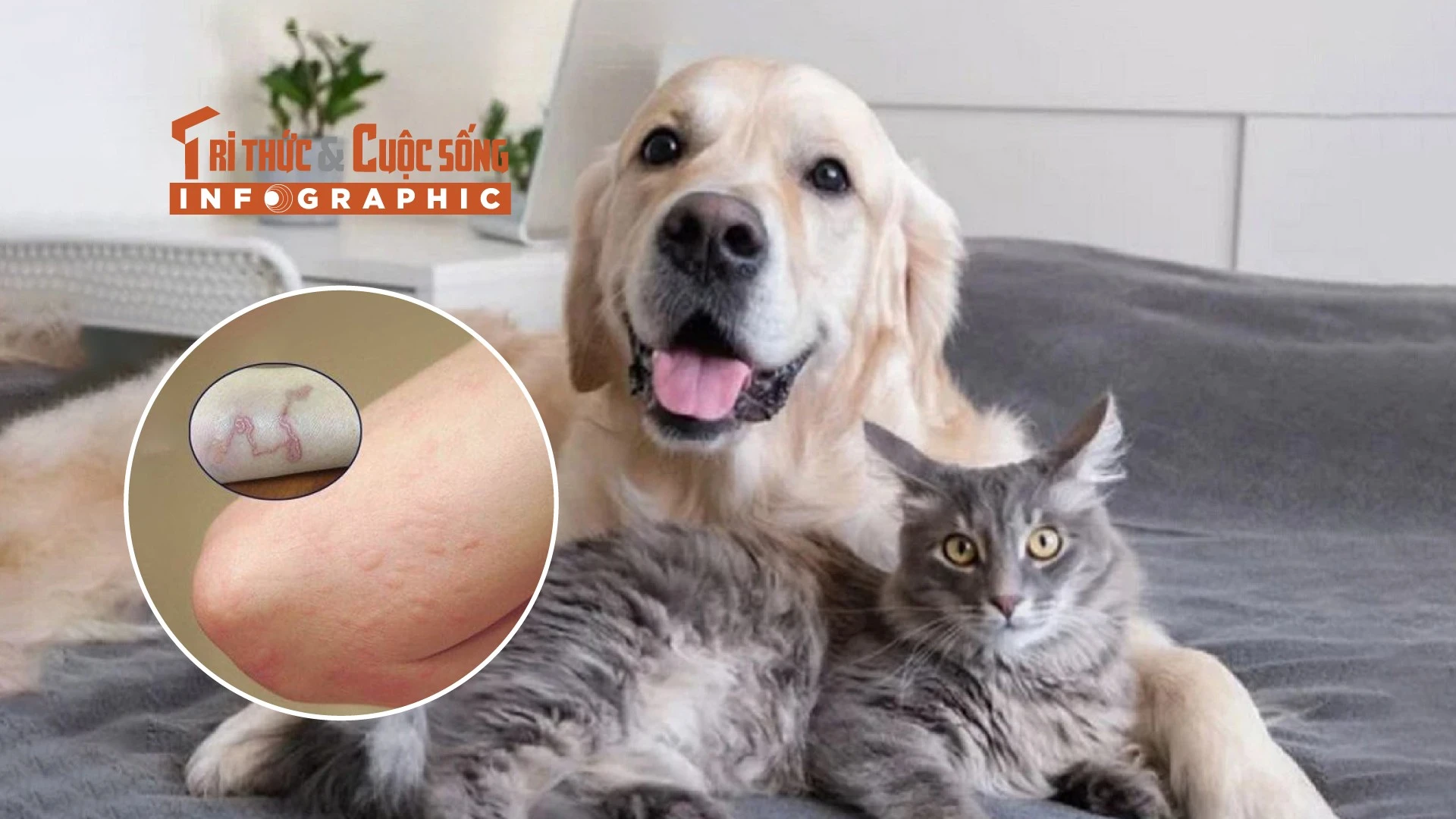 [INFOGRAPHIC] Triệu chứng bệnh sán chó mèo ở người