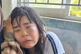 Nữ sinh lớp 7 bị đánh hội đồng gây phẫn nộ ở Quảng Ngãi