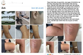 Người đàn ông tại Quảng Ngãi hành hung trẻ vị thành niên gây phẫn nộ