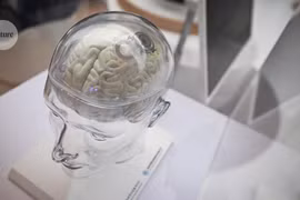 Quên Neuralink đi, chip não này làm được điều mà Elon Musk thèm muốn