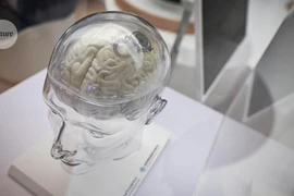 Quên Neuralink đi, chip não này làm được điều mà Elon Musk thèm muốn