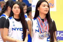 Hạt Dẻ vướng tranh cãi 1 chi tiết khác xưa trên gương mặt