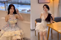 Gặp tai nạn mất một cánh tay, cô gái vẫn nổi tiếng nhờ nhan sắc khó cưỡng