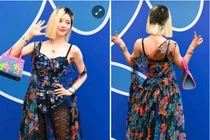 'DJ gợi cảm nhất Hàn Quốc' không còn che giấu mái tóc bị rụng cả mảng