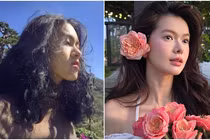 Cô gái Việt là 'nhân chứng' cho sự thay đổi cuộc sống nhờ 'dao kéo'