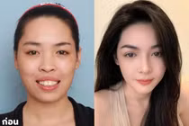 10 năm sau ca phẫu thuật 'đổi đời', Vũ Thanh Quỳnh giờ ra sao?