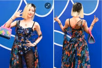 'DJ gợi cảm nhất Hàn Quốc' không còn che giấu mái tóc bị rụng cả mảng