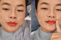 Diện mạo khác lạ của chú rể Hoa Cương sau lần được vợ đưa đi thẩm mỹ