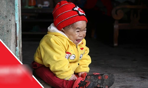 Video: Cô gái 28 tuổi mang hình hài của đứa trẻ lên 3