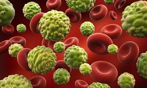 Video: 4 lý do khiến 257 người việt chết vì ung thư mỗi ngày