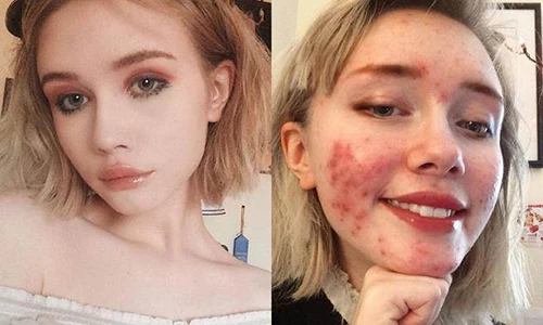 Mệt mỏi vì sống ảo, hot girl lộ mặt thật khiến dân tình sốc nặng