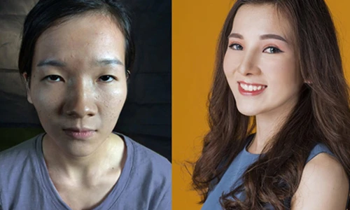 Video: 5 cô gái xấu xí trở thành hot girl sau khi "dao kéo"