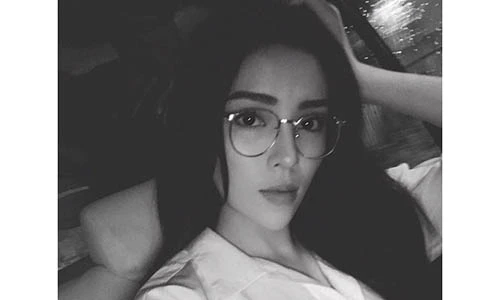 Gương mặt gầy gò, hốc hác gây sốc của Hoa hậu Kỳ Duyên