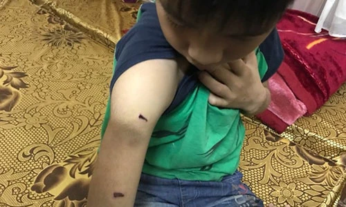 Video: Bé 9 tuổi nghi bị bố bạo hành chỉ rõ từng vết thương trên cơ thể