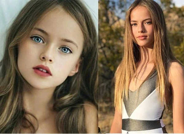 Ngỡ ngàng trước nhan sắc hiện tại của "bé gái đẹp nhất thế giới"
