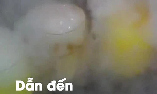 Video: Xem video này còn ai dám để nước ngọt vào ngăn đá