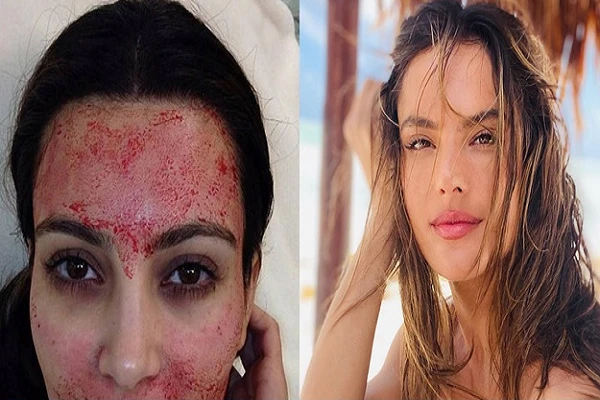 Phương pháp làm đẹp kì lạ của sao Hollywood