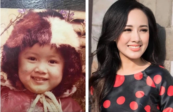 BTV Hoài Anh bất ngờ lên tiếng về tin đồn sửa mũi