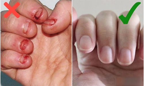 Video: 10 thói quen khiến bạn vừa tốn thời gian vừa trở nên xấu xí