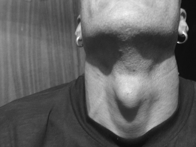 Video: Tại sao nam giới lại có 'quả táo của Adam'?