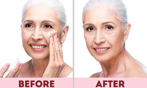 Điểm mặt 9 sản phẩm làm đẹp vô tác dụng, chỉ gây lãng phí tiền