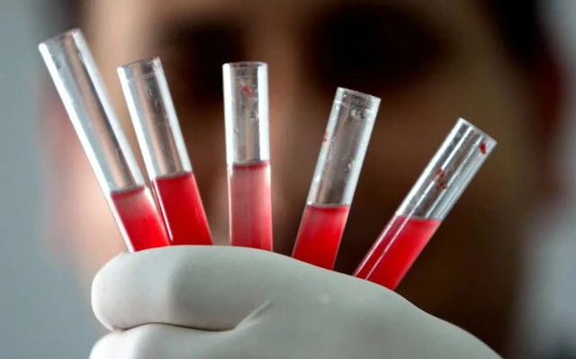 Video: Nhóm máu hiếm nhất thế giới chỉ có 43 người sở hữu