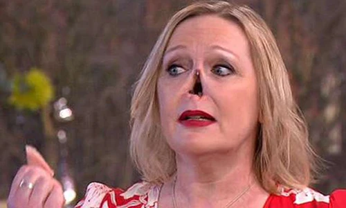 Video: Người phụ nữ gây sốc khi tháo mũi giả trên sóng truyền hình