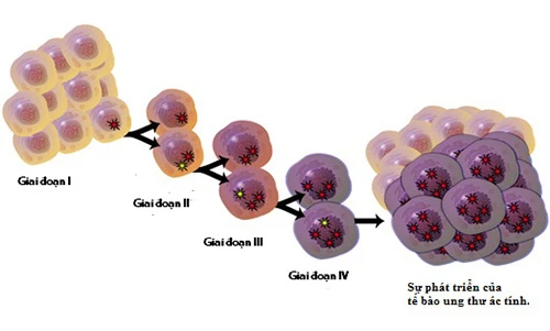 8 hiểu nhầm vô cùng nguy hại về bệnh ung thư