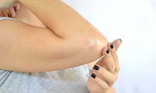 Mẹo loại bỏ vết thâm ở khuỷu tay thần kỳ