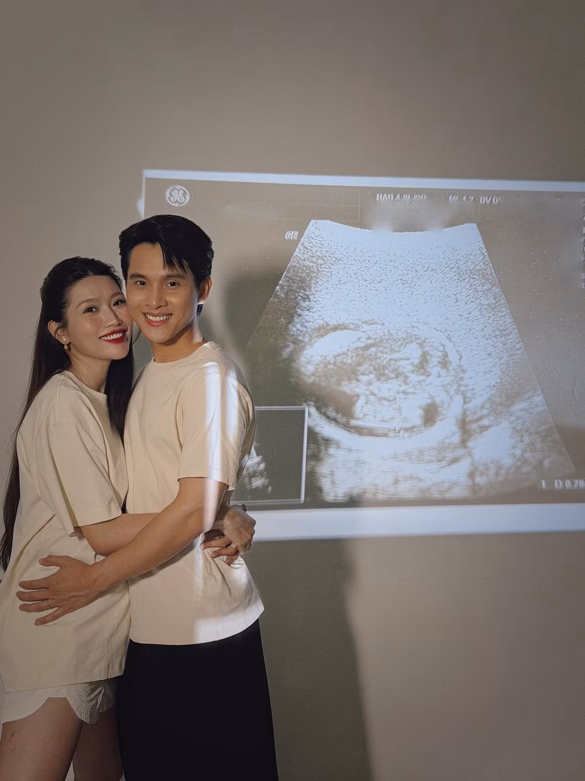 Tin tức sao Việt 9/12: Á hậu Hòa bình Việt Nam 2022 Quỳnh Châu công bố tin vui có thai con đầu lòng với ông xã - doanh nhân Phát Nguyễn. Ảnh: FB Chế Nguyễn Quỳnh Châu