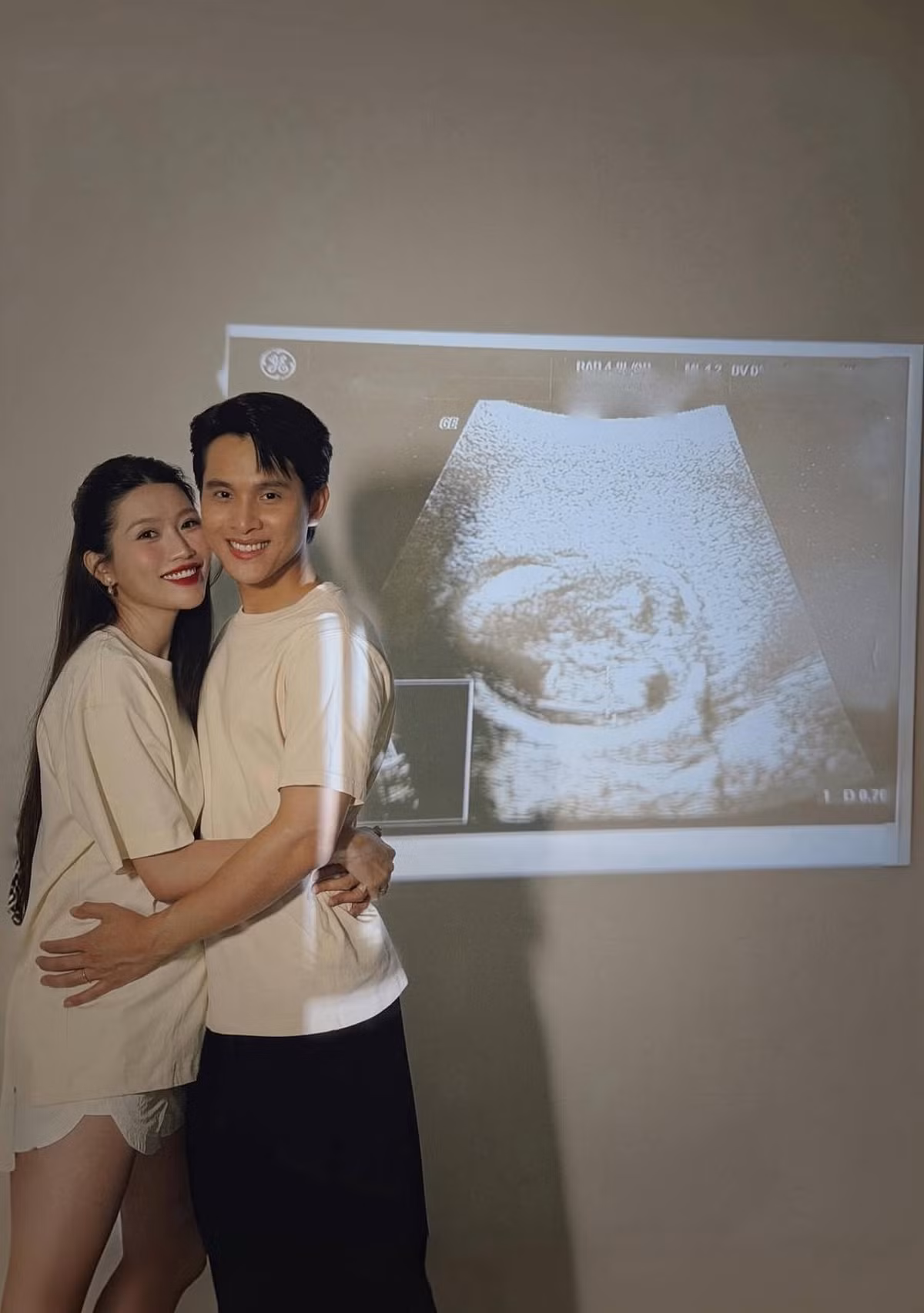 Cách đây không lâu, Á hậu Chế Nguyễn Quỳnh Châu xác nhận đang mang thai con đầu lòng, đánh dấu cột mốc mới trong cuộc sống hôn nhân. Người đẹp cho biết cô và ông xã vô cùng hạnh phúc khi đón nhận tin vui này sau thời gian kết hôn.