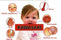 View - Cận cảnh Kawasaki Z400 2026 vừa mở bán, hơn 135 triệu đồng | Báo Tri thức và Cuộc sống - TIN TỨC PHỔ BIẾN KIẾN THỨC 24H