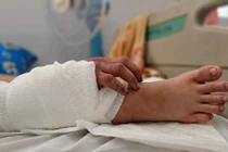 Kỳ tích ghép tay vào chân để cứu tay đứt lìa cho thai phụ 20 tuổi