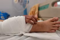 Kỳ tích ghép tay vào chân để cứu tay đứt lìa cho thai phụ 20 tuổi