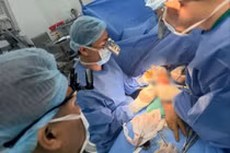 Tái tạo dương vật cho bệnh nhân bỏng điện cao thế