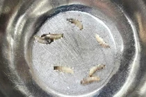 Không chú ý vệ sinh, ổ dòi làm tổ trong hốc mũi 