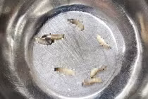 Không chú ý vệ sinh, ổ dòi làm tổ trong hốc mũi 