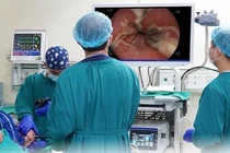 Loét nặng từ miệng đến dạ dày sau khi uống rượu hoa quả