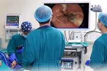 Loét nặng từ miệng đến dạ dày sau khi uống rượu hoa quả