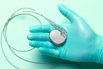 Khắc phục cơn ngưng tim kéo dài bằng máy tạo nhịp