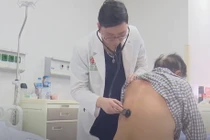 Đau ngực âm ỉ, người đàn ông bị bóc tách động mạch chủ đe dọa tính mạng