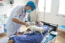 Xử lý bỏng sai nguy hại khôn lường